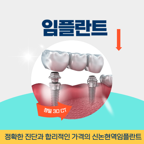 원주치과 원주시 치과 임플란트
