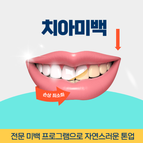 원주치과 원주시 치과 치아미백