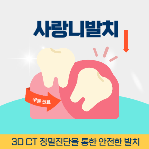 원주치과 원주시 치과 사랑니 발치