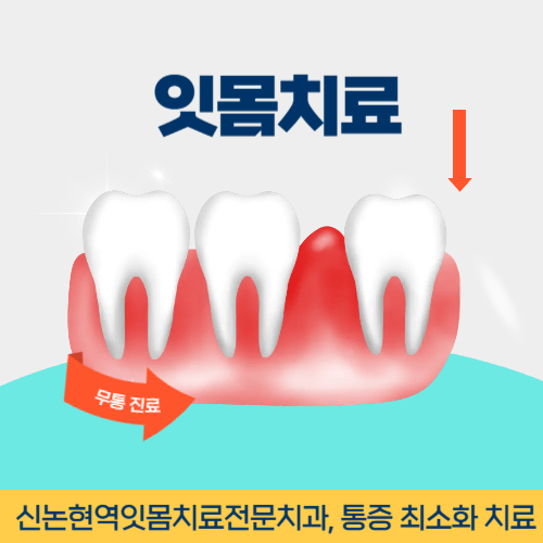 원주치과 원주시 치과 잇몸치료
